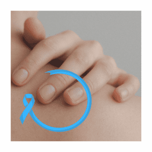 ¿TE GUSTA EL BRONCEADO?: HABLEMOS DE CÁNCER DE PIEL
