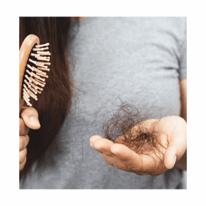 SE ME ESTÁ CAYENDO EL PELO!: Lo que necesitas saber sobre la alopecia y qué hacer al respecto